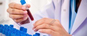 Photo of a woman lab technician holding a blood specimen